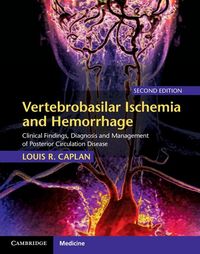 Produktbild: Vertebrobasilar Ischemia and Hemorrhage