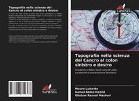 Produktbild: Topografia nella scienza del Cancro al colon sinistro e destro