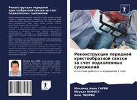 Produktbild: Rekonstrukciq perednej krestoobraznoj swqzki za schet podkolennyh suhozhilij