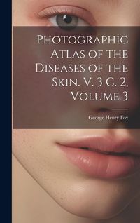 Produktbild: Photographic Atlas of the Diseases of the Skin. V. 3 C. 2, Volume 3