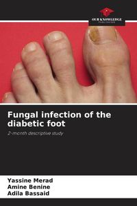 Produktbild: Fungal infection of the diabetic foot