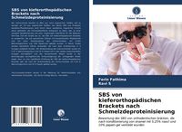 Produktbild: SBS von kieferorthop&auml;dischen Brackets nach Schmelzdeproteinisierung