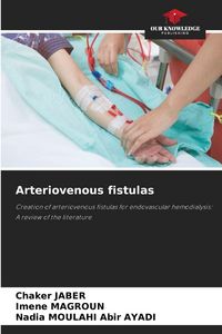 Produktbild: Arteriovenous fistulas