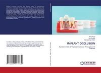 Produktbild: Implant Occlusion