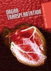 Produktbild: Fullick, A: Organ Transplantation
