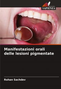 Produktbild: Manifestazioni orali delle lesioni pigmentate