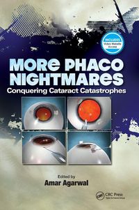 Produktbild: More Phaco Nightmares
