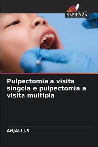 Produktbild: Pulpectomia a visita singola e pulpectomia a visita multipla