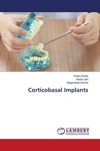 Produktbild: Corticobasal Implants