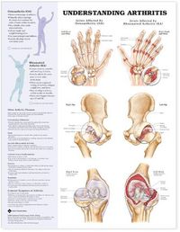 Produktbild: Tbd: Understanding Arthritis Paper