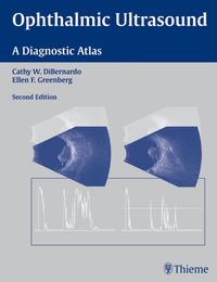 Produktbild: Ophthalmic Ultrasound