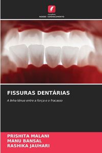 Produktbild: Fissuras Dent&aacute;rias