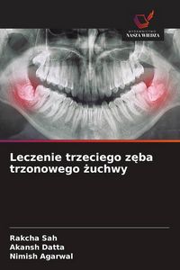 Produktbild: Leczenie trzeciego z&iquest;ba trzonowego &iquest;uchwy