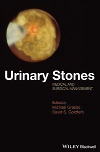 Produktbild: Urinary Stones