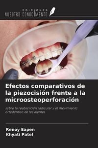 Produktbild: Efectos comparativos de la piezocisi&oacute;n frente a la microosteoperforaci&oacute;n