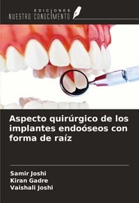Produktbild: Aspecto quir&uacute;rgico de los implantes endo&oacute;seos con forma de ra&iacute;z