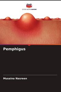 Produktbild: Pemphigus