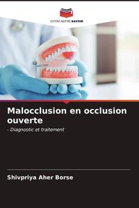 Produktbild: Malocclusion en occlusion ouverte