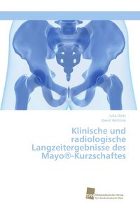 Produktbild: Klinische und radiologische Langzeitergebnisse des Mayo&reg;-Kurzschaftes