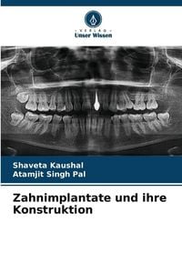 Produktbild: Zahnimplantate und ihre Konstruktion