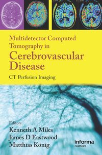 Produktbild: Multidetector Computed Tomography in Cerebrovascular Disease