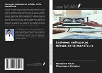 Produktbild: Lesiones radiopacas mixtas de la mand&iacute;bula