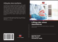 Produktbild: Lifting des sinus maxillaires