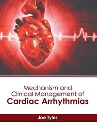 Produktbild: Mechanism and Clinical Management of Cardiac Arrhythmias