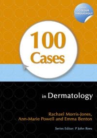 Produktbild: 100 Cases in Dermatology
