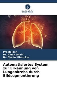 Produktbild: Automatisiertes System zur Erkennung von Lungenkrebs durch Bildsegmentierung