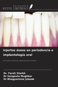 Produktbild: Injertos &oacute;seos en periodoncia e implantolog&iacute;a oral