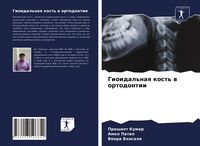 Produktbild: Gioidal'naq kost' w ortodontii