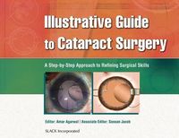 Produktbild: Agarwal, A: Illustrative Guide to Cataract Surgery
