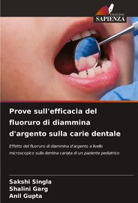 Produktbild: Prove sull'efficacia del fluoruro di diammina d'argento sulla carie dentale
