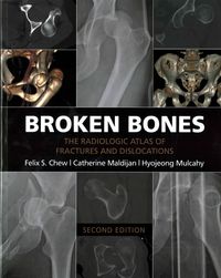 Produktbild: Broken Bones