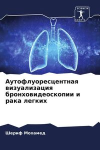 Produktbild: Autofluorescentnaq wizualizaciq bronhowideoskopii i raka legkih