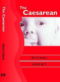 Produktbild: The Caesarean