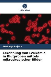 Produktbild: Erkennung von Leuk&auml;mie in Blutproben mittels mikroskopischer Bilder