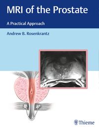 Produktbild: MRI of the Prostate