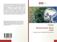 Produktbild: Reconstruction 3D du cr&acirc;ne