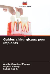 Produktbild: Guides chirurgicaux pour implants