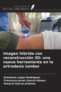 Produktbild: Imagen h&iacute;brida con reconstrucci&oacute;n 3D: una nueva herramienta en la artrodesis lumbar