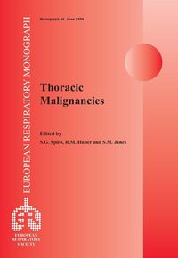 Produktbild: Thoracic Malignancies