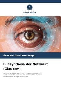 Produktbild: Bildsynthese der Netzhaut (Glaukom)