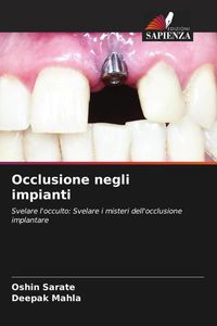 Produktbild: Occlusione negli impianti