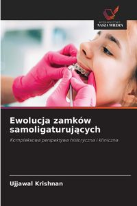 Produktbild: Ewolucja zamk&oacute;w samoligaturuj&iquest;cych