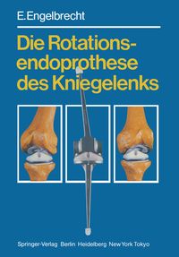 Produktbild: Die Rotationsendoprothese des Kniegelenks