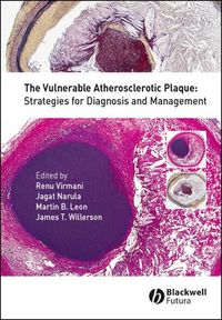 Produktbild: The Vulnerable Atherosclerotic Plaque