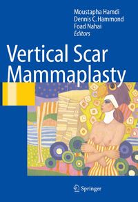 Produktbild: Vertical Scar Mammaplasty