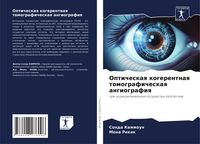 Produktbild: Opticheskaq kogerentnaq tomograficheskaq angiografiq